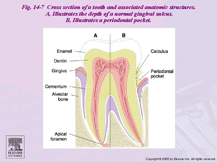 Fig. 14 -7 Cross section of a tooth and associated anatomic structures. A, Illustrates