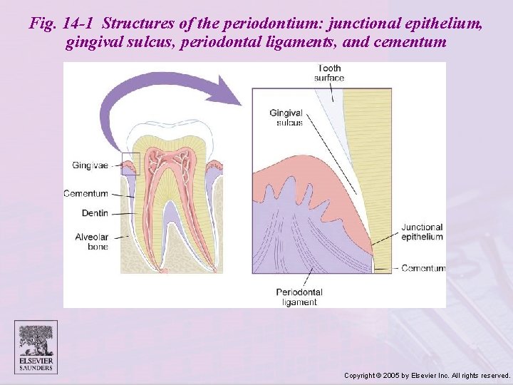 Fig. 14 -1 Structures of the periodontium: junctional epithelium, gingival sulcus, periodontal ligaments, and