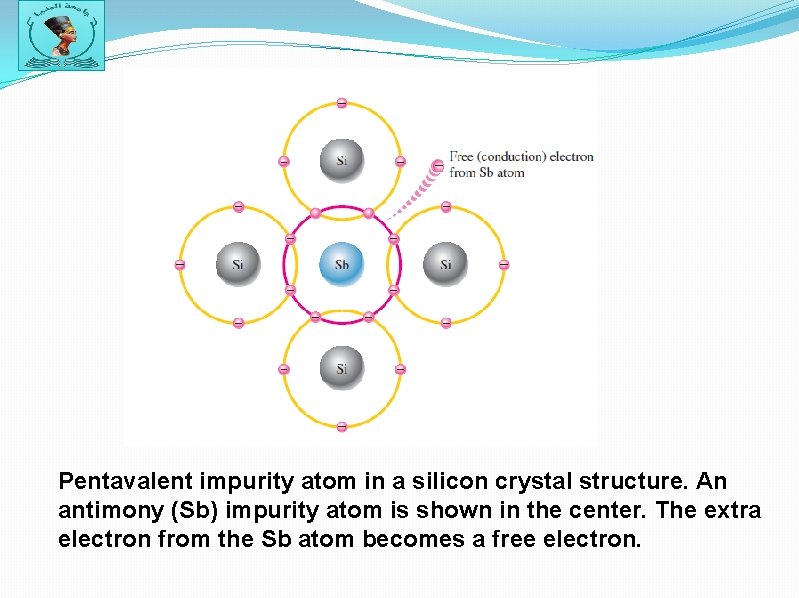 Pentavalent impurity atom in a silicon crystal structure. An antimony (Sb) impurity atom is