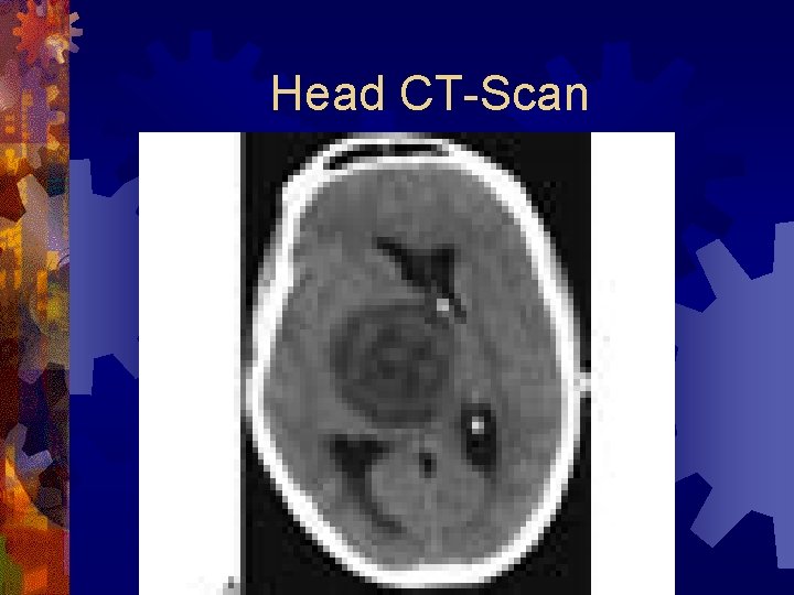 Head CT-Scan 