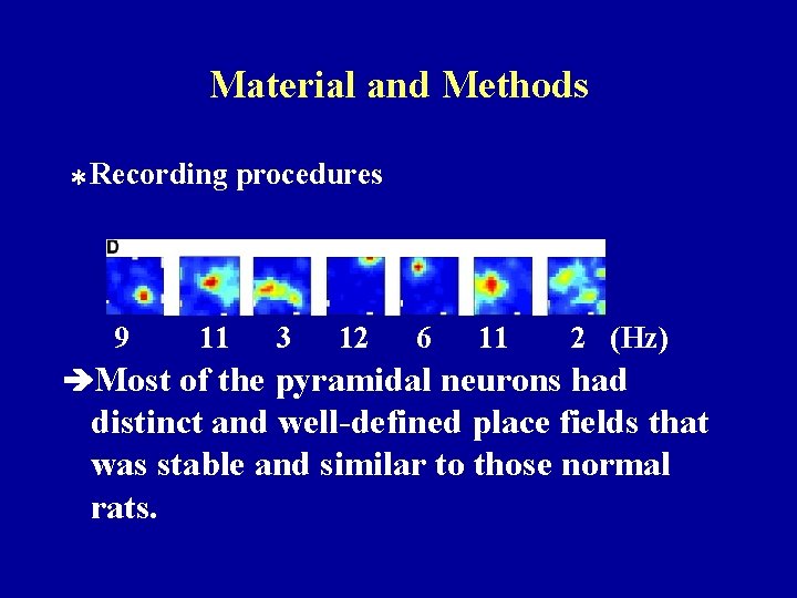 Material and Methods ＊Recording 9 11 procedures 3 12 6 11 2 (Hz) Most