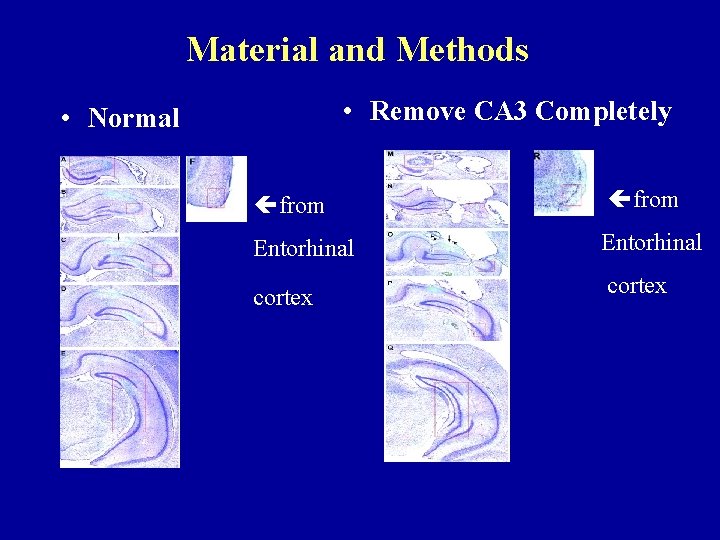Material and Methods • Remove CA 3 Completely • Normal from Entorhinal cortex 
