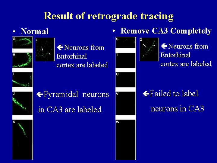 Result of retrograde tracing • Remove CA 3 Completely • Normal Neurons from Entorhinal