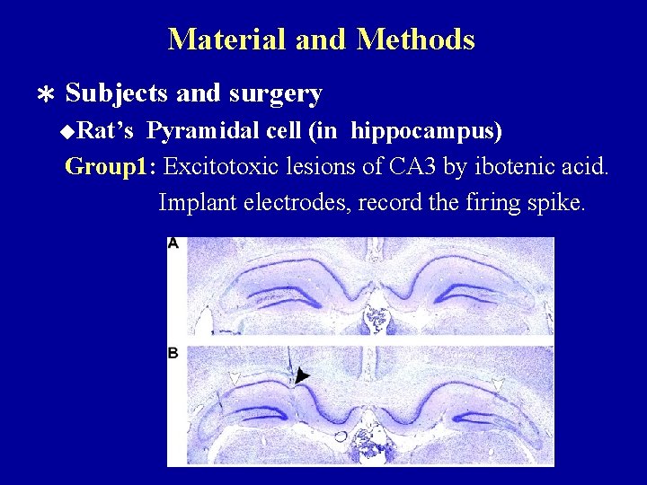 Material and Methods ＊ Subjects and surgery ◆Rat’s Pyramidal cell (in hippocampus) Group 1: