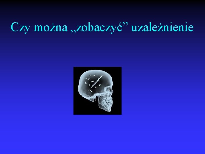 Czy można „zobaczyć” uzależnienie 