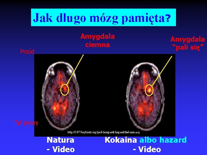Jak długo mózg pamięta? Amygdala ciemna Przód Amygdala “pali się” Tył głowy http: //1877