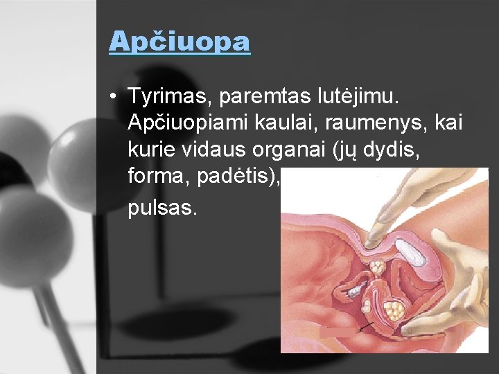 Apčiuopa • Tyrimas, paremtas lutėjimu. Apčiuopiami kaulai, raumenys, kai kurie vidaus organai (jų dydis,