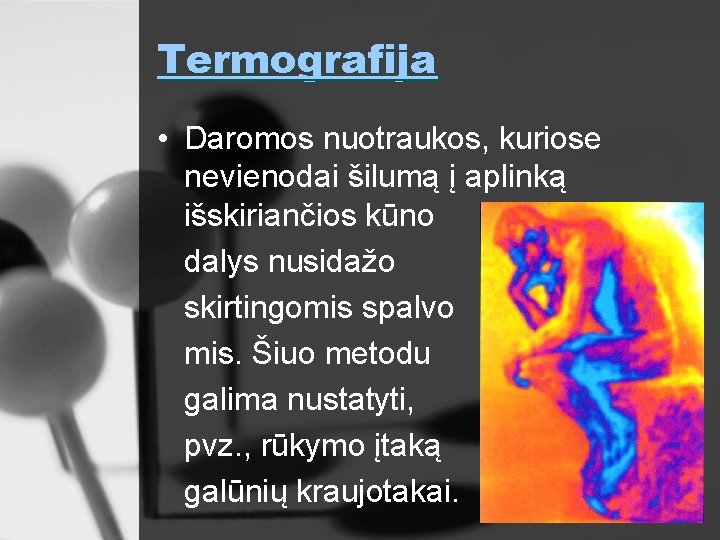 Termografija • Daromos nuotraukos, kuriose nevienodai šilumą į aplinką išskiriančios kūno dalys nusidažo skirtingomis
