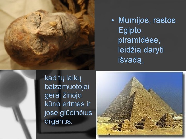  • Mumijos, rastos Egipto piramidėse, leidžia daryti išvadą, kad tų laikų balzamuotojai gerai