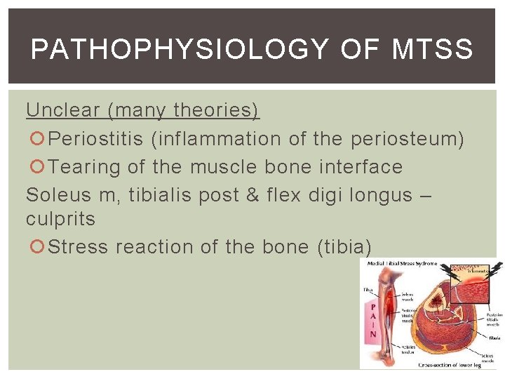 PATHOPHYSIOLOGY OF MTSS Unclear (many theories) Periostitis (inflammation of the periosteum) Tearing of the PATHOPHYSIOLOGY OF MTSS Unclear (many theories) Periostitis (inflammation of the periosteum) Tearing of the