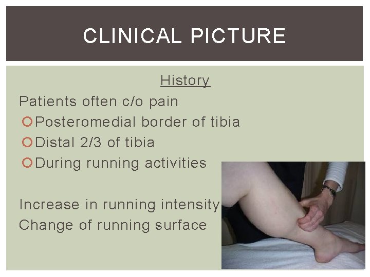 CLINICAL PICTURE History Patients often c/o pain Posteromedial border of tibia Distal 2/3 of