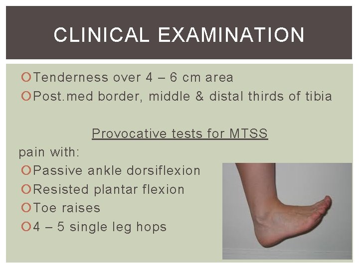 CLINICAL EXAMINATION Tenderness over 4 – 6 cm area Post. med border, middle &