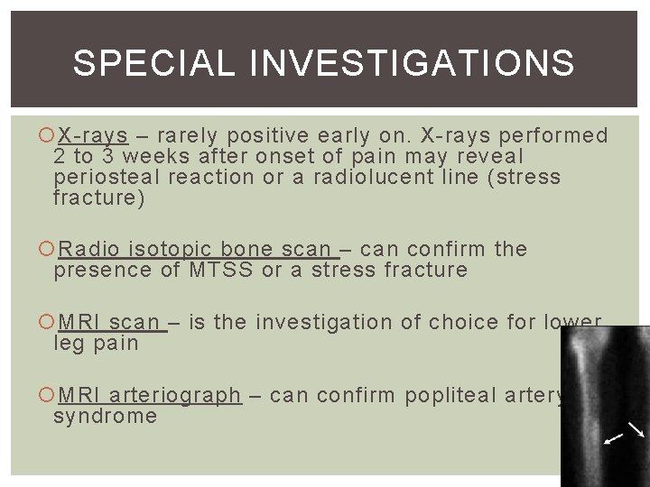 SPECIAL INVESTIGATIONS X-rays – rarely positive early on. X-rays performed 2 to 3 weeks