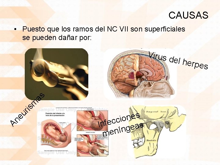 CAUSAS • Puesto que los ramos del NC VII son superficiales se pueden dañar