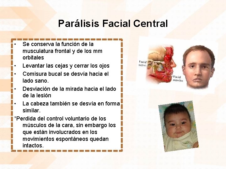 Parálisis Facial Central • Se conserva la función de la musculatura frontal y de