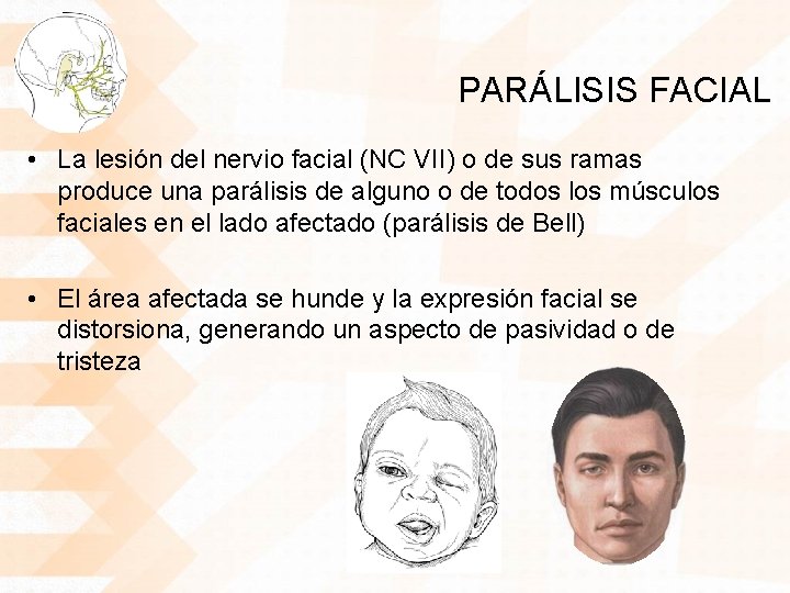 PARÁLISIS FACIAL • La lesión del nervio facial (NC VII) o de sus ramas