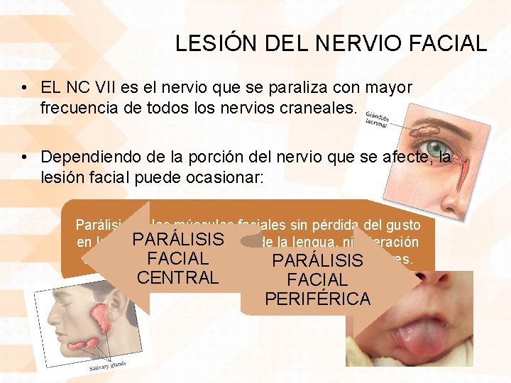 LESIÓN DEL NERVIO FACIAL • EL NC VII es el nervio que se paraliza