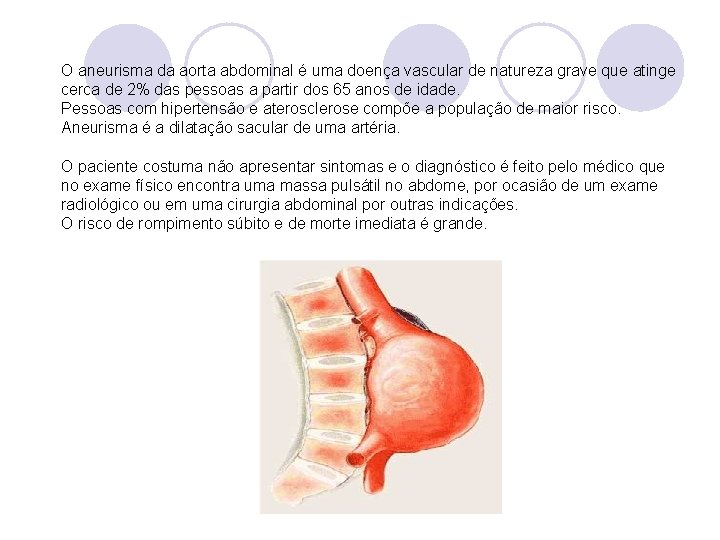 O aneurisma da aorta abdominal é uma doença vascular de natureza grave que atinge