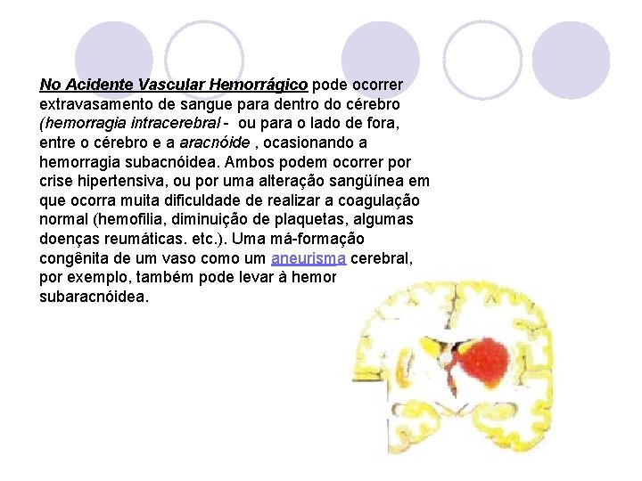 No Acidente Vascular Hemorrágico pode ocorrer extravasamento de sangue para dentro do cérebro (hemorragia