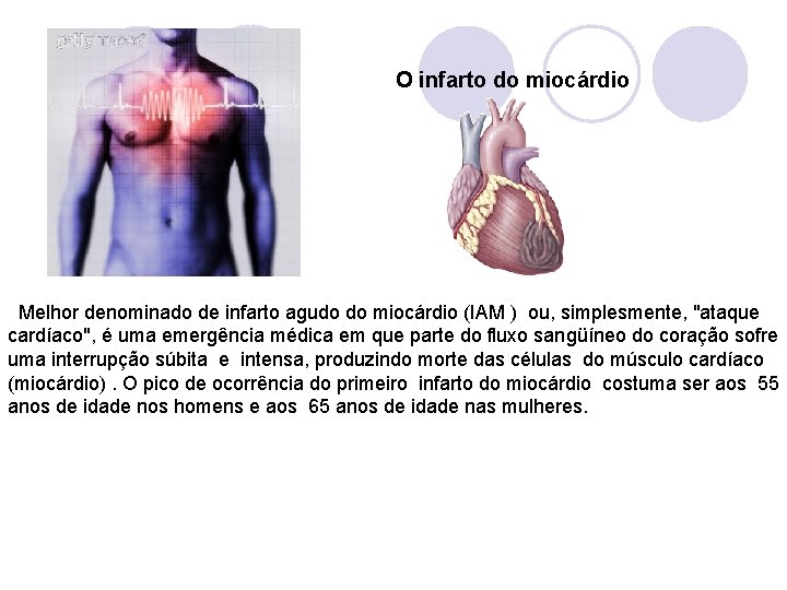  O infarto do miocárdio Melhor denominado de infarto agudo do miocárdio (IAM )