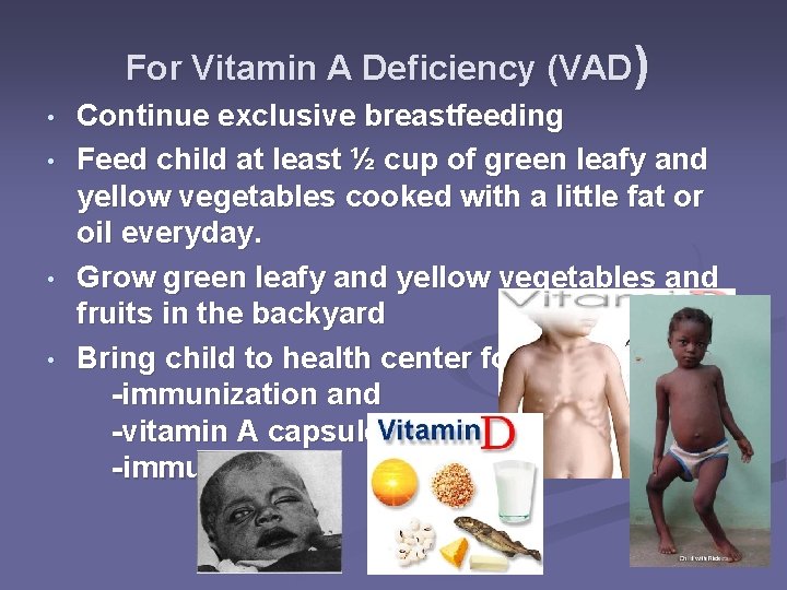 For Vitamin A Deficiency (VAD) • • Continue exclusive breastfeeding Feed child at least