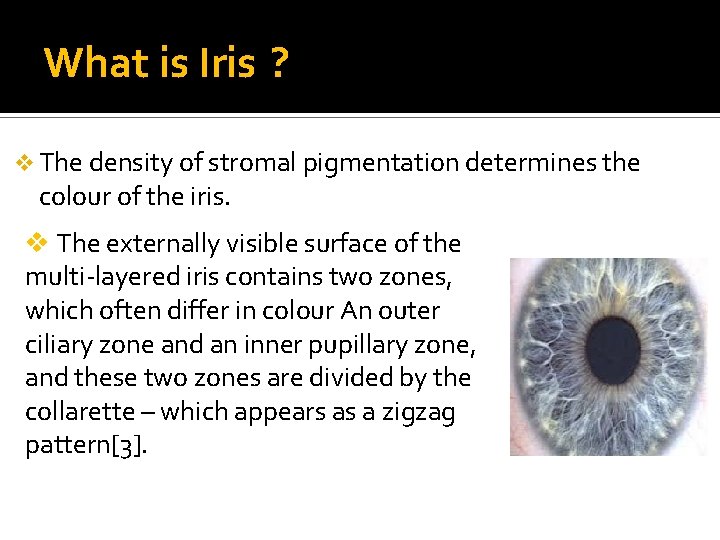 What is Iris ? v The density of stromal pigmentation determines the colour of