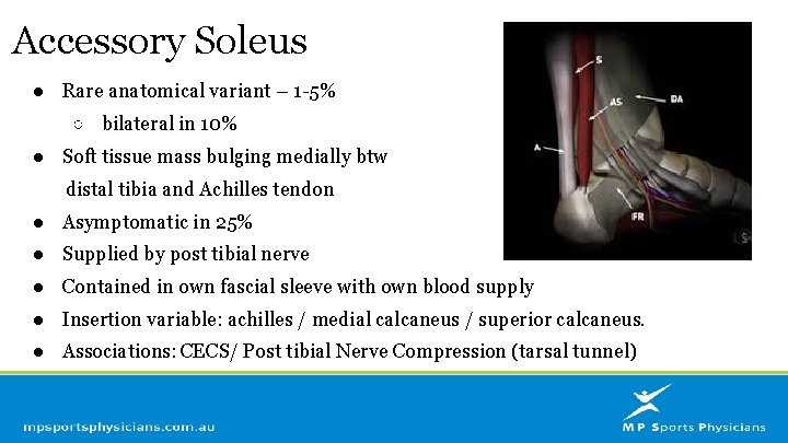 Accessory Soleus ● Rare anatomical variant – 1 -5% ○ bilateral in 10% ●