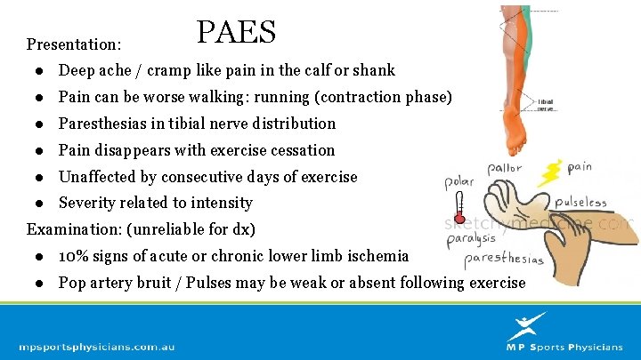 Presentation: PAES ● Deep ache / cramp like pain in the calf or shank