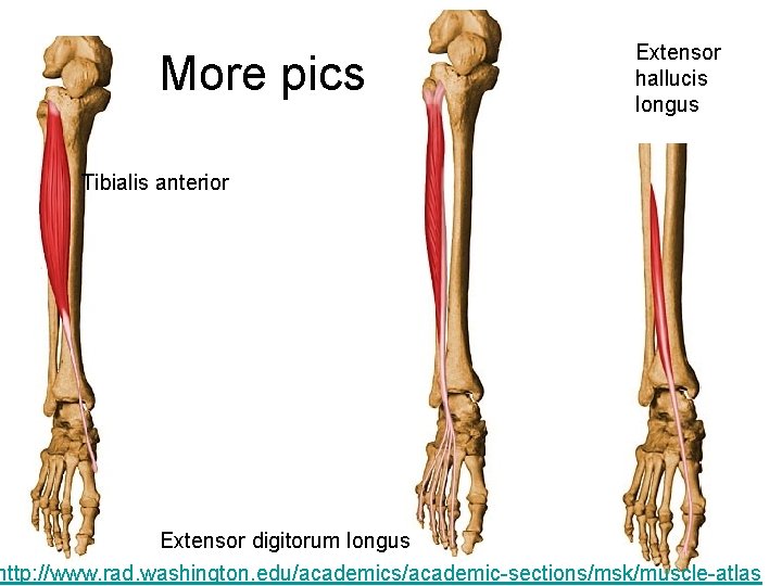 More pics Extensor hallucis longus Tibialis anterior Extensor digitorum longus http: //www. rad. washington.