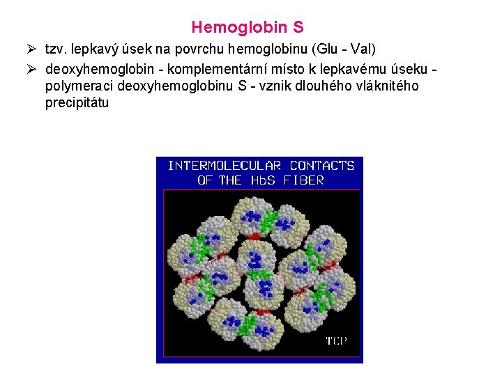 Hemoglobin S Ø tzv. lepkavý úsek na povrchu hemoglobinu (Glu - Val) Ø deoxyhemoglobin
