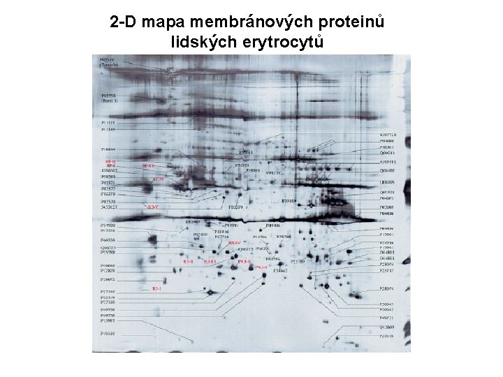 2 -D mapa membránových proteinů lidských erytrocytů 