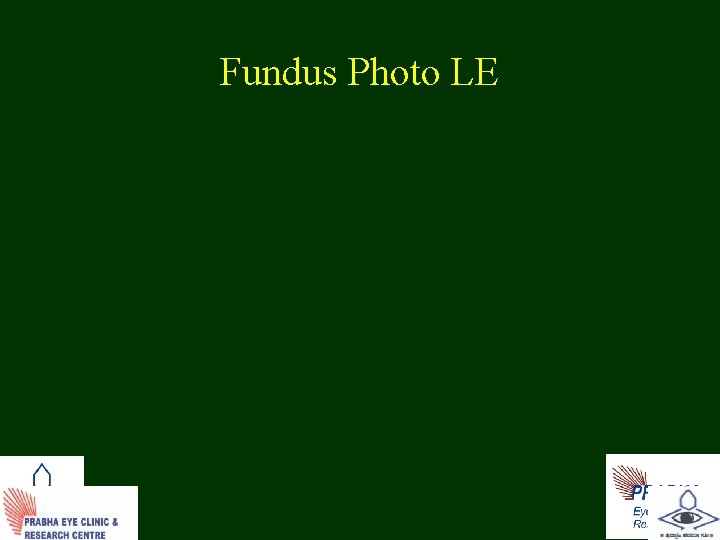 Fundus Photo LE 