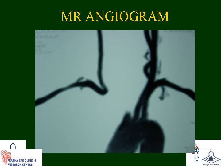 MR ANGIOGRAM 