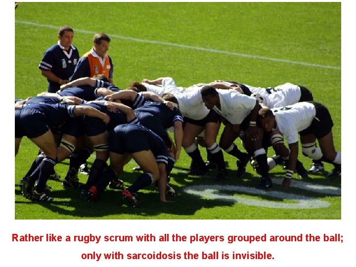 Rather like a rugby scrum with all the players grouped around the ball; only