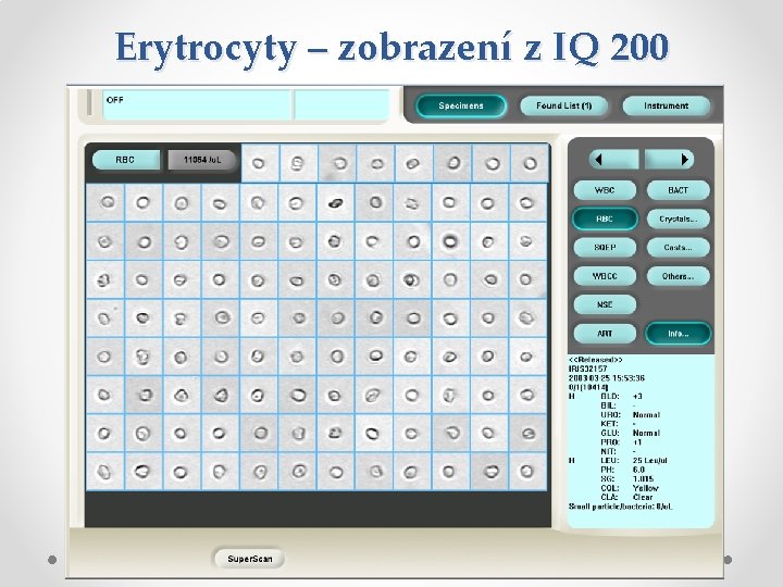 Erytrocyty – zobrazení z IQ 200 Erytrocyty – zobrazení z IQ 200