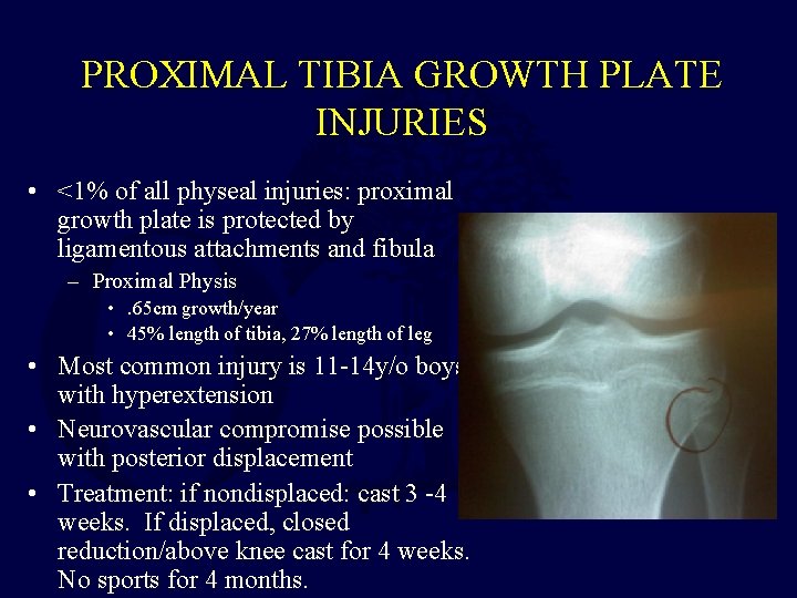 PROXIMAL TIBIA GROWTH PLATE INJURIES • <1% of all physeal injuries: proximal growth plate