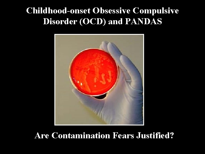 Childhood-onset Obsessive Compulsive Disorder (OCD) and PANDAS Are Contamination Fears Justified? 