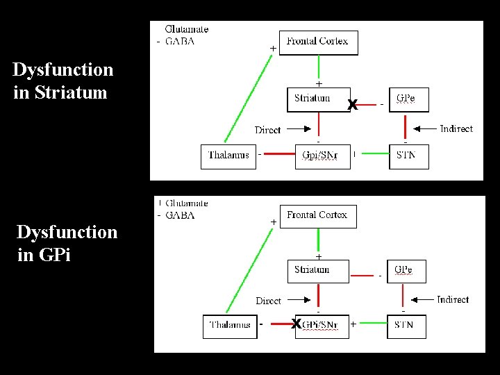 Dysfunction in Striatum Dysfunction in GPi 