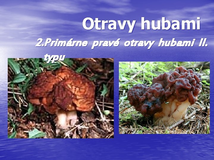 Otravy hubami 2. Primárne pravé otravy hubami II. typu Otravy hubami 2. Primárne pravé otravy hubami II. typu