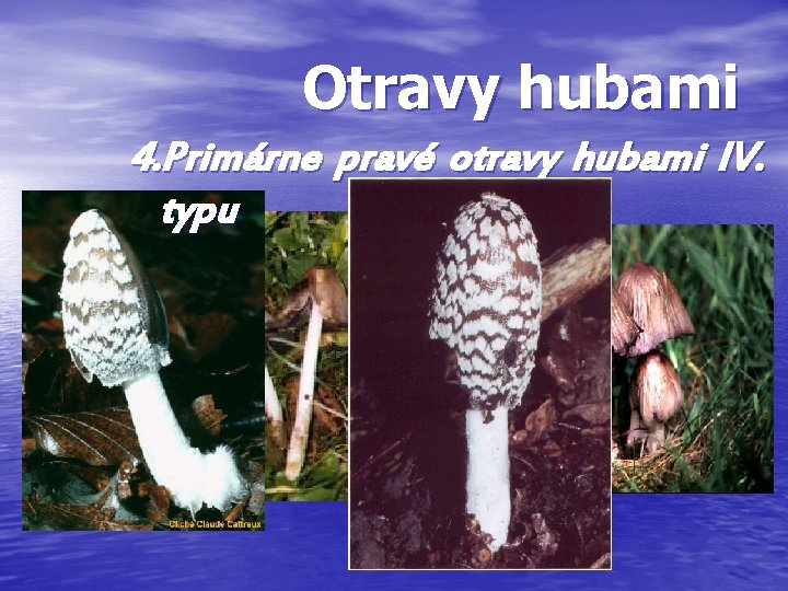 Otravy hubami 4. Primárne pravé otravy hubami IV. typu Otravy hubami 4. Primárne pravé otravy hubami IV. typu