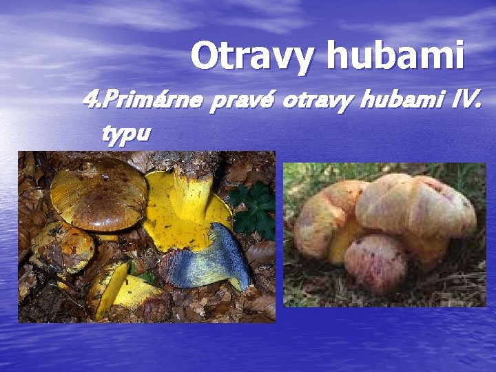 Otravy hubami 4. Primárne pravé otravy hubami IV. typu Otravy hubami 4. Primárne pravé otravy hubami IV. typu