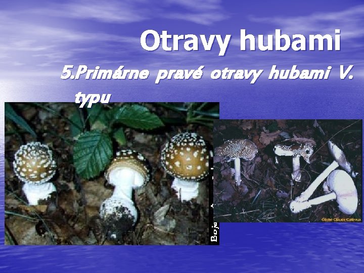 Otravy hubami 5. Primárne pravé otravy hubami V. typu 