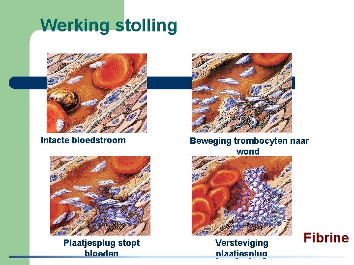  Werking stolling Intacte bloedstroom Plaatjesplug stopt bloeden Beweging trombocyten naar wond Versteviging plaatjesplug