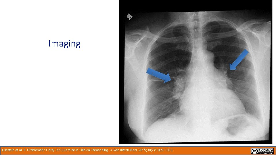 Imaging Einstein et al. A Problematic Palsy: An Exercise in Clinical Reasoning. J Gen