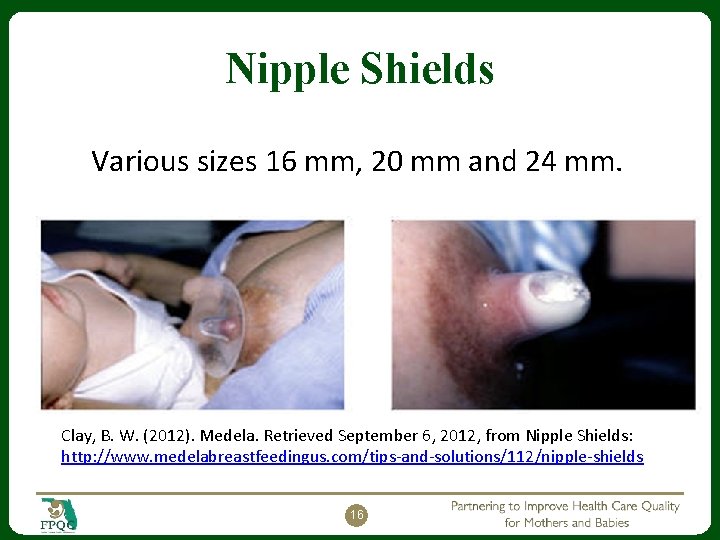 Nipple Shields Various sizes 16 mm, 20 mm and 24 mm. Clay, B. W.