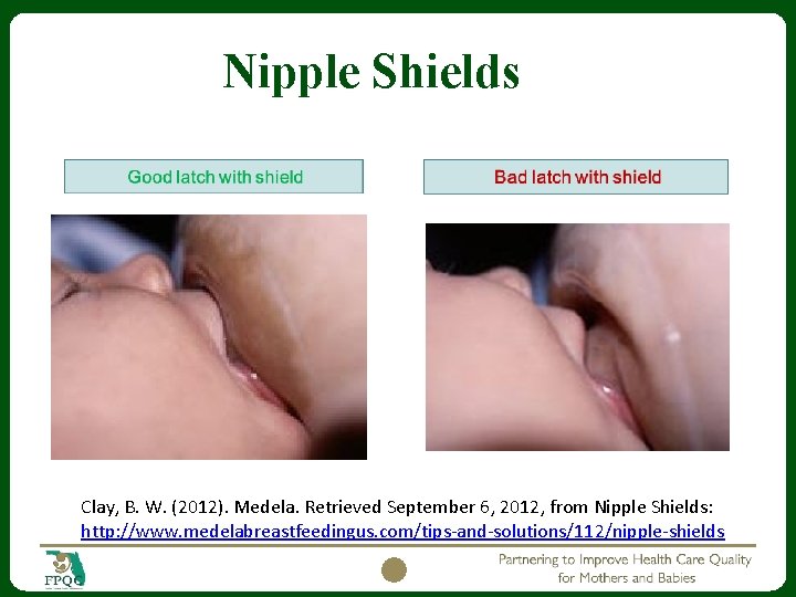 Nipple Shields Clay, B. W. (2012). Medela. Retrieved September 6, 2012, from Nipple Shields: