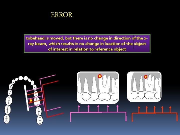 ERROR tubehead is moved, but there is no change in direction of the xray