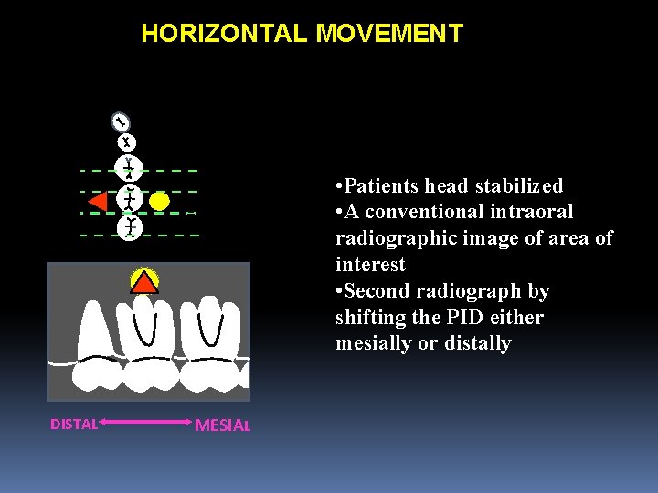 HORIZONTAL MOVEMENT • Patients head stabilized • A conventional intraoral radiographic image of area