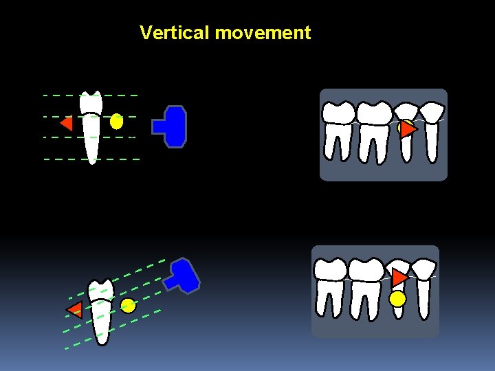 Vertical movement 