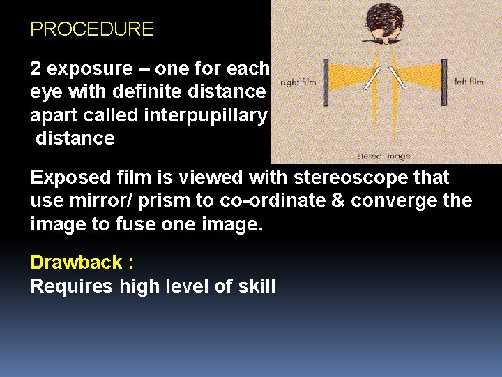 PROCEDURE 2 exposure – one for each eye with definite distance apart called interpupillary